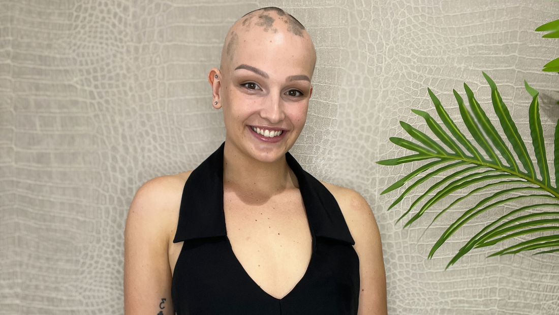 Celebrities Breaking Stigma: Embracing Alopecia with Style